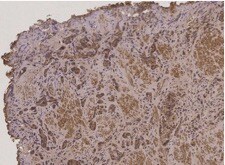 TMSB15B Antibody - BSA Free NBP2-38054