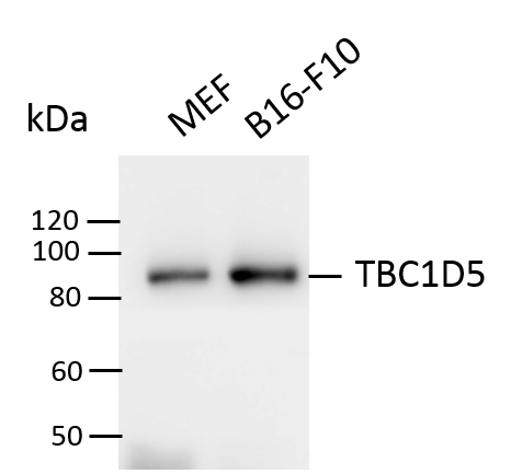 TBC1D5 Antibody - BSA Free NBP2-38237