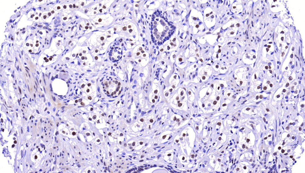 Dnmt3L Antibody - BSA Free NBP2-39076