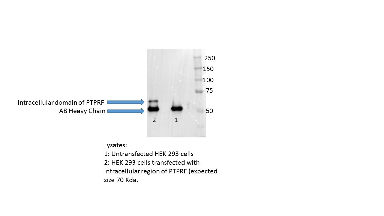 LAR/PTPRF Antibody (S165-38) - BSA Free NBP2-42172