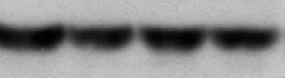 SLC34A1 Antibody (10B1.3E9) - BSA Free NBP2-42216