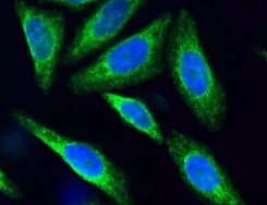SSR2 Antibody (31G6) - BSA Free NBP2-42647