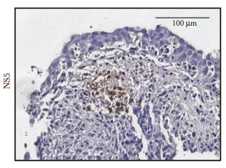 Dengue Virus NS5 Antibody NBP2-42900