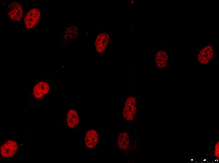 RNASEH2B Antibody (673) - Azide and BSA Free NBP2-43776