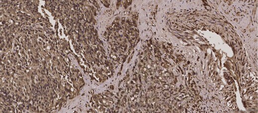 TNF-alpha Antibody - Azide and BSA Free NBP2-44062