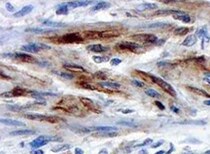 Caldesmon/CALD1 Antibody (h-CALD) NBP2-44421