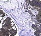 MUC3 Antibody (MUC3/1154) NBP2-44434