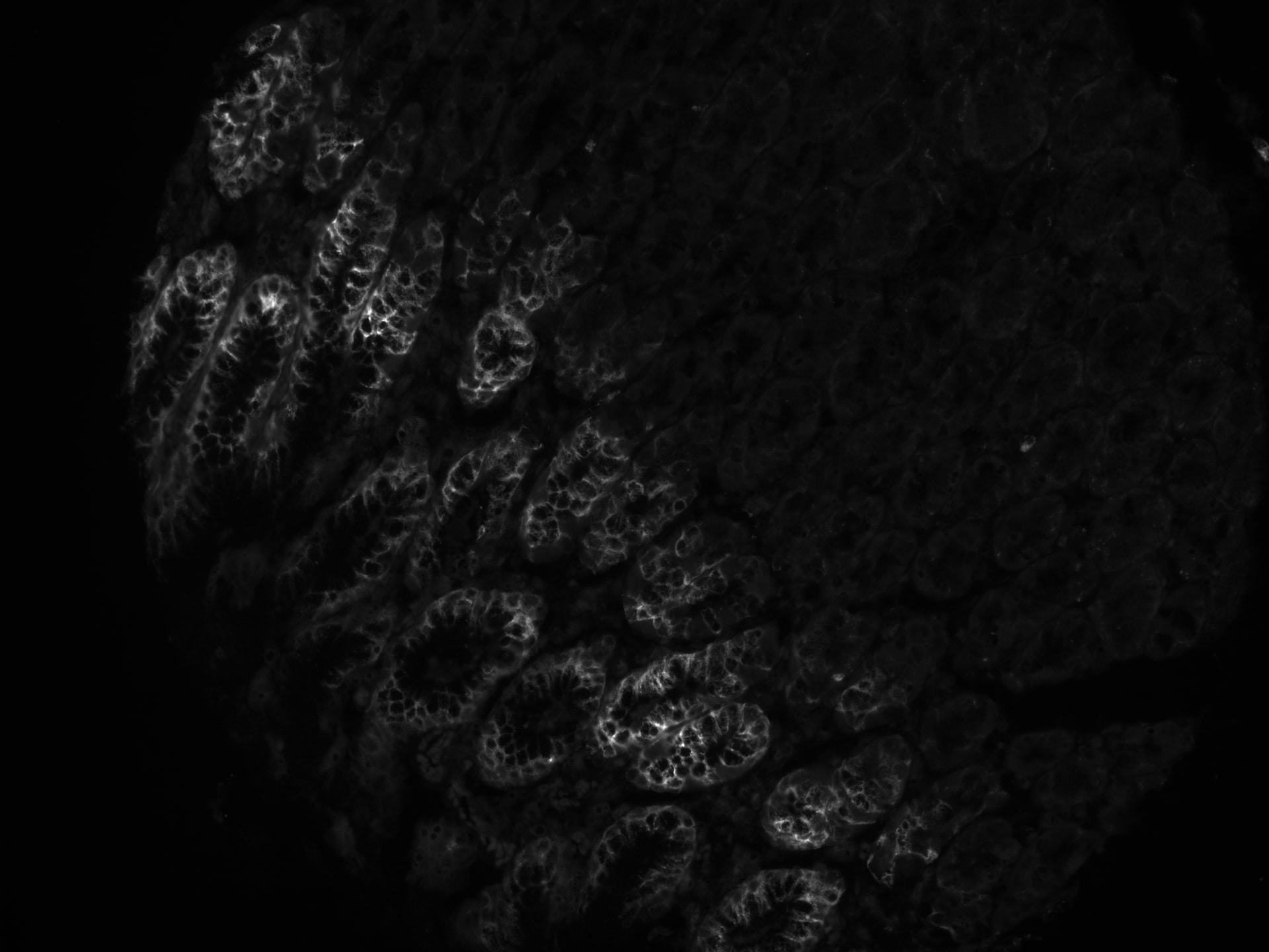 MUC5AC Antibody (CLH2) NBP2-44455