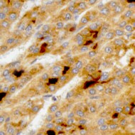 Glypican 3 Antibody (1G12) NBP2-44484
