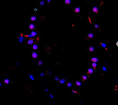 TTF-1 / NKX2-1 Antibody (8G7G3/1 + NX2.1/690) NBP2-44501