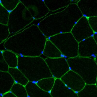 Laminin gamma 1 Antibody (A5) NBP2-44751