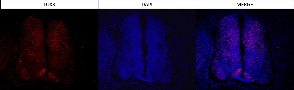 TOX3 Antibody (TOX3/1123) NBP2-45165