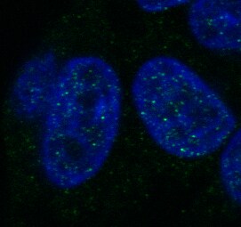 Histone H1 Antibody (HH1/957) NBP2-45184