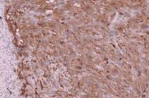 CA19-9/Sialyl Lewis A Antibody (SPM588) NBP2-45199