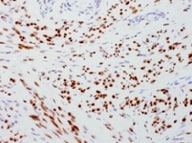 Progesterone Antibody (6-5E-10B) NBP2-45210