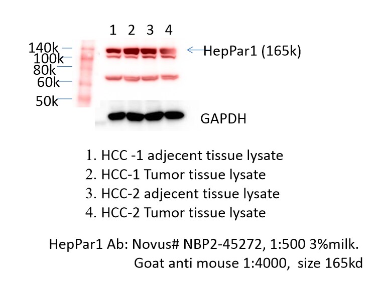 Hepatocyte Specific Antigen Antibody (HepPar1) NBP2-45272