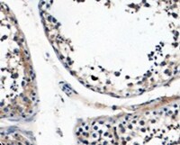 Nuclear Antigen Antibody (NM106) NBP2-45273