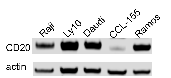 CD20 Antibody (OTI4B4) NBP2-45454