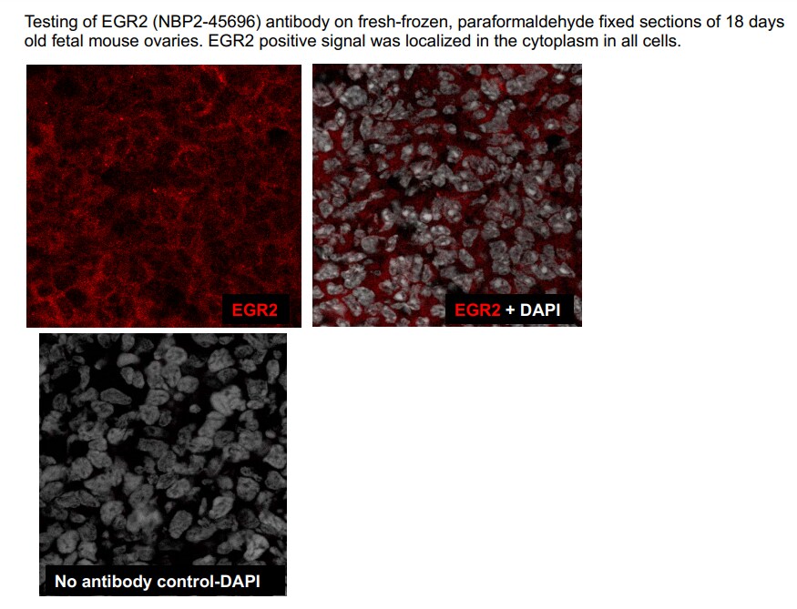 EGR2 Antibody (OTI1B12) NBP2-45696