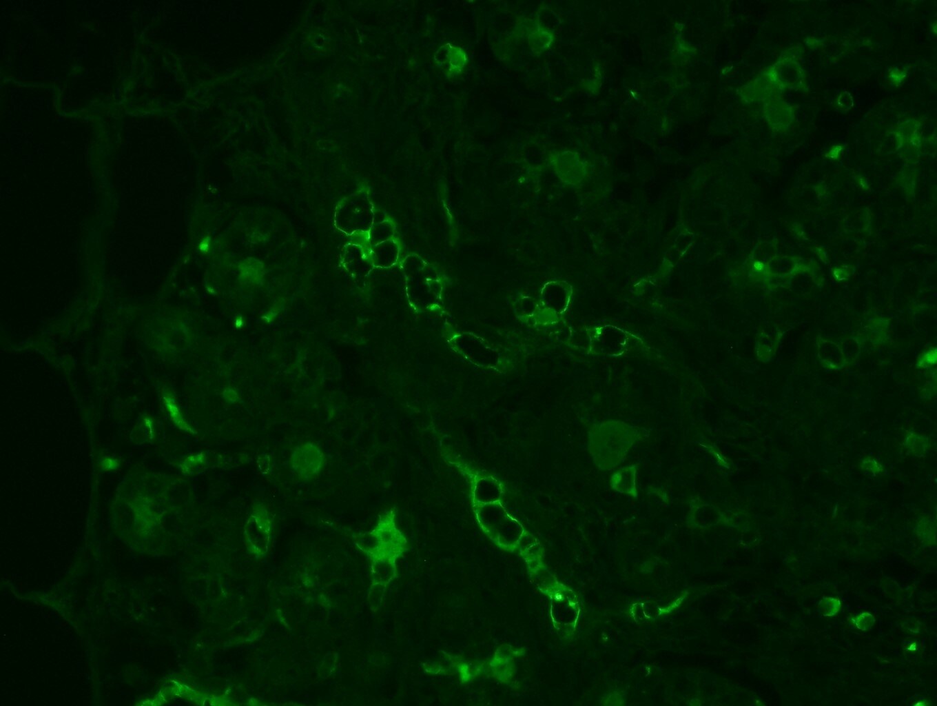 MAdCAM-1 Antibody (OTI1A5) NBP2-45706