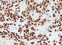 GATA-3 Antibody (OTI8H4) NBP2-45810