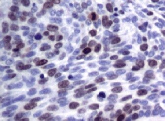 MOX1 Antibody (OTI5B11) NBP2-45819