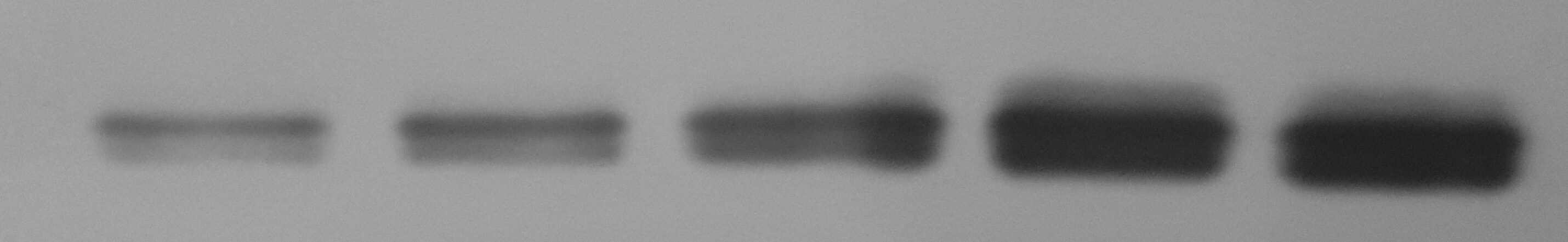 MMP-13 Antibody (OTI2D8) NBP2-45887