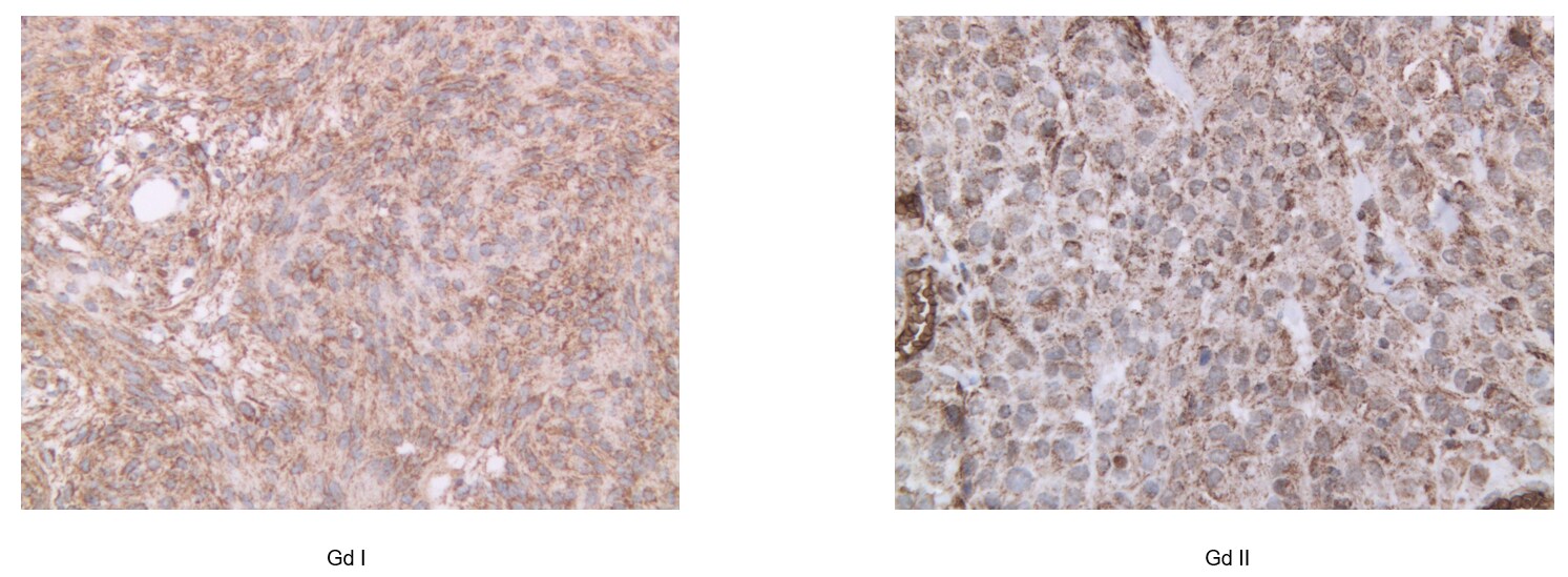 MSRB3 Antibody (OTI2A2) NBP2-46023