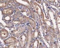IL-10R alpha Antibody (OTI1D10) NBP2-46049