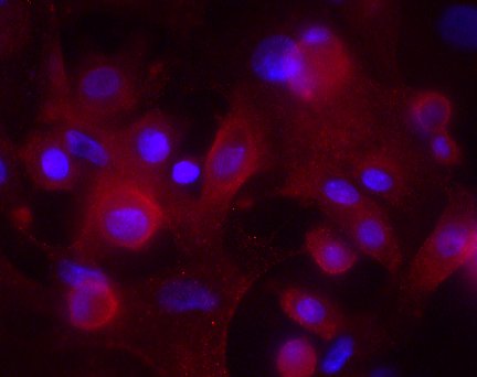 MAD4 Antibody (OTI7F7) NBP2-46060