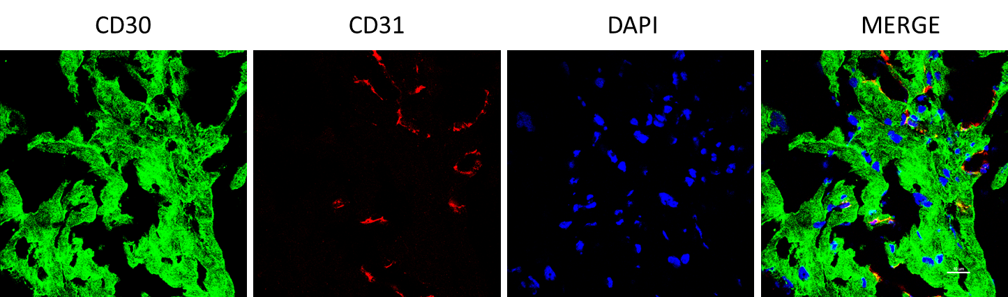 CD30/TNFRSF8 Antibody (OTI1C6) NBP2-46157