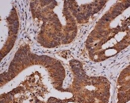 Troponin I Type 1 (slow skeletal) Antibody (OTI8H8) NBP2-46170