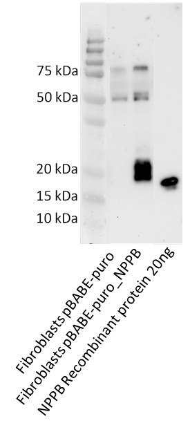 NT-proBNP Antibody (OTI11G4) NBP2-46201