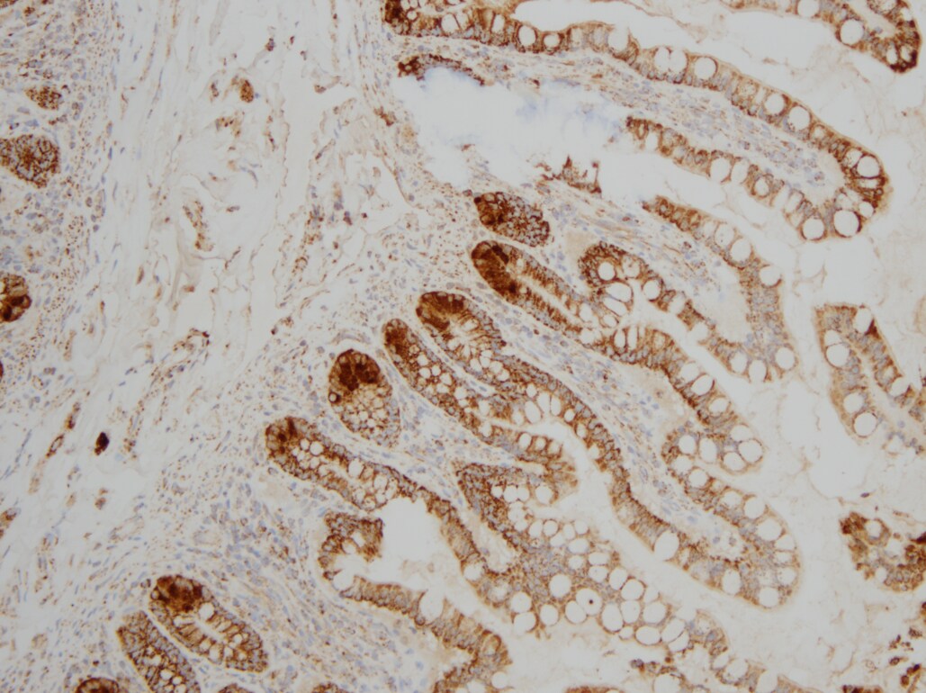 PI 3-Kinase p110 delta Antibody (OTI1D11) NBP2-46404