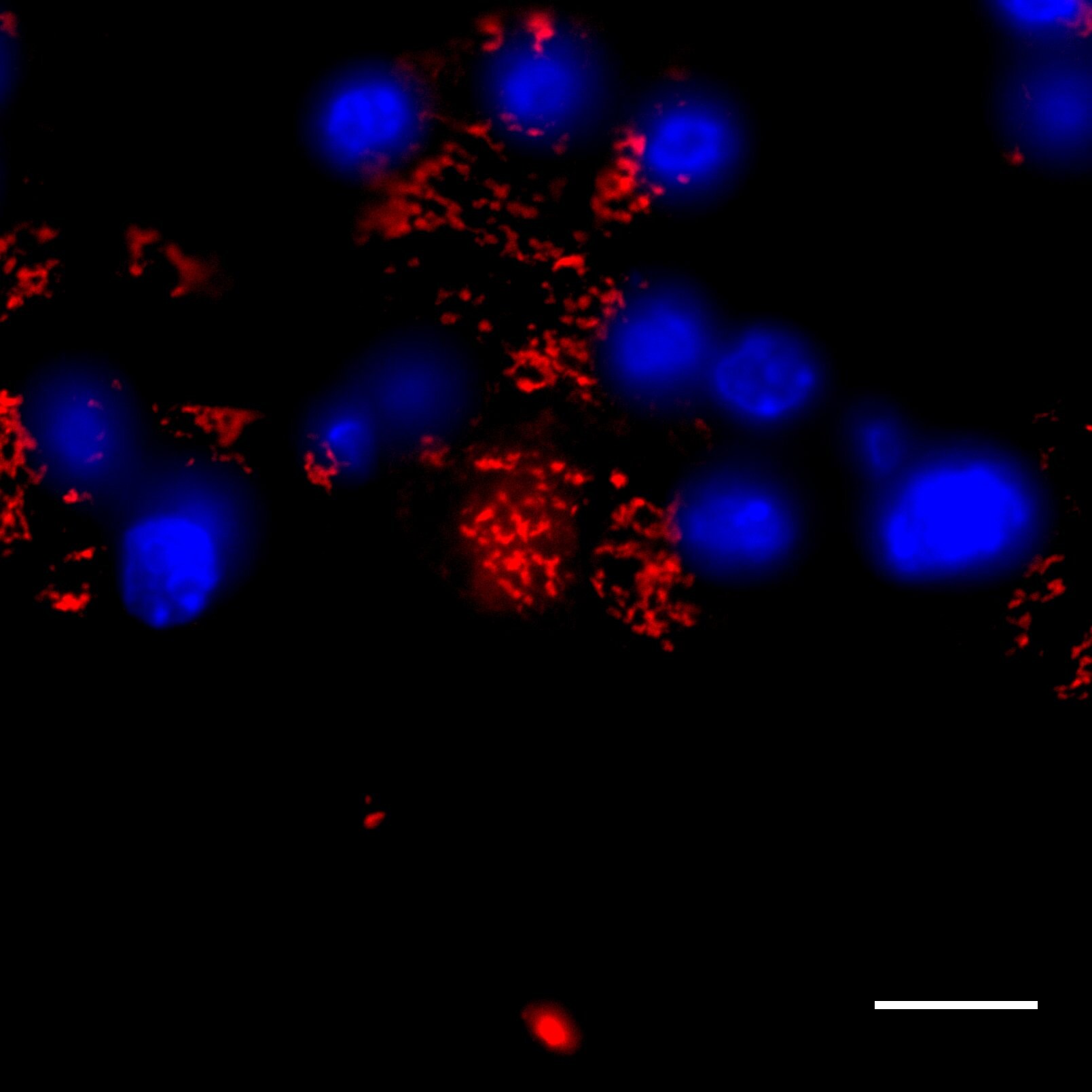 Pancreatic Amylase Alpha Antibody (OTI1E3) NBP2-46518