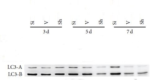 LC3B Antibody (1251A) - BSA Free NBP2-46892