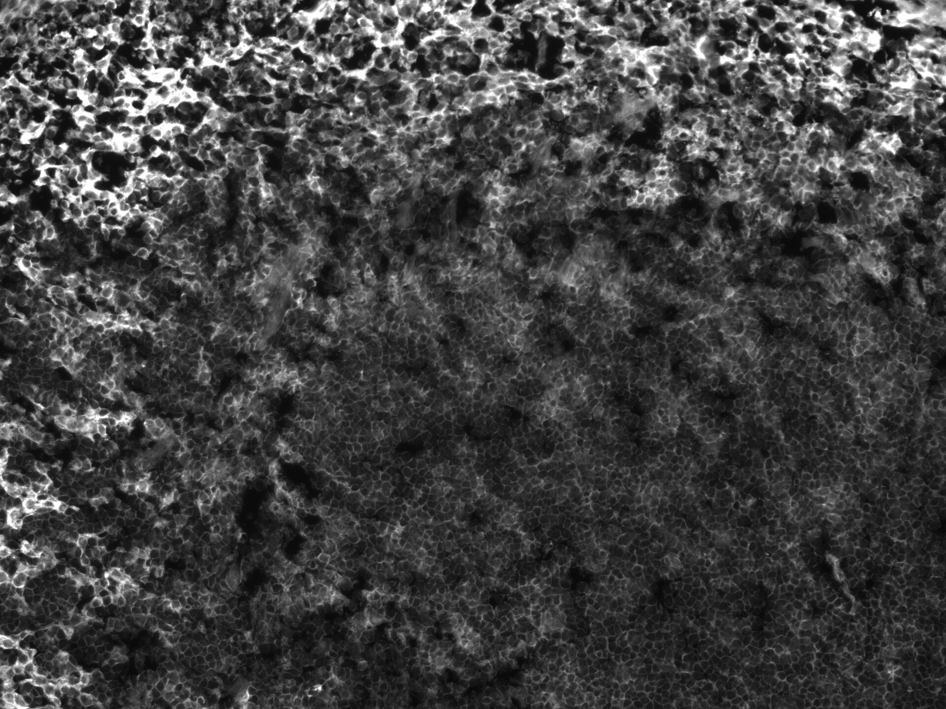 CD47 Antibody (IAP/964 + B6H12.2) - Azide and BSA Free NBP2-47812