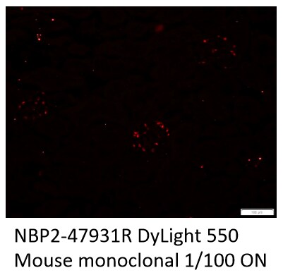 WT1 Antibody (WT1/857) [DyLight 550] NBP2-47931R