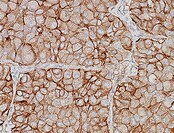 5'-Nucleotidase/CD73 Antibody (AD2) - BSA Free NBP2-48480