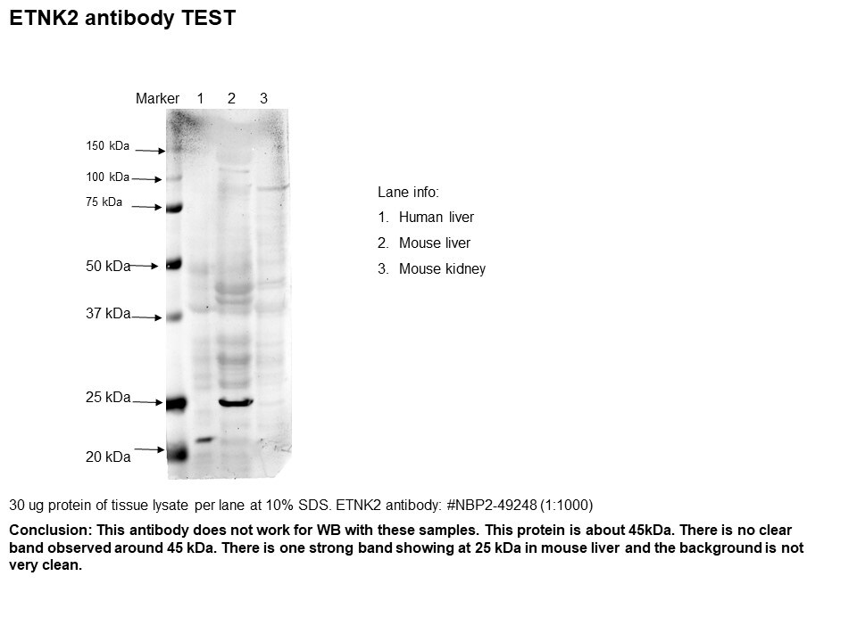 ETNK2 Antibody - BSA Free NBP2-49248