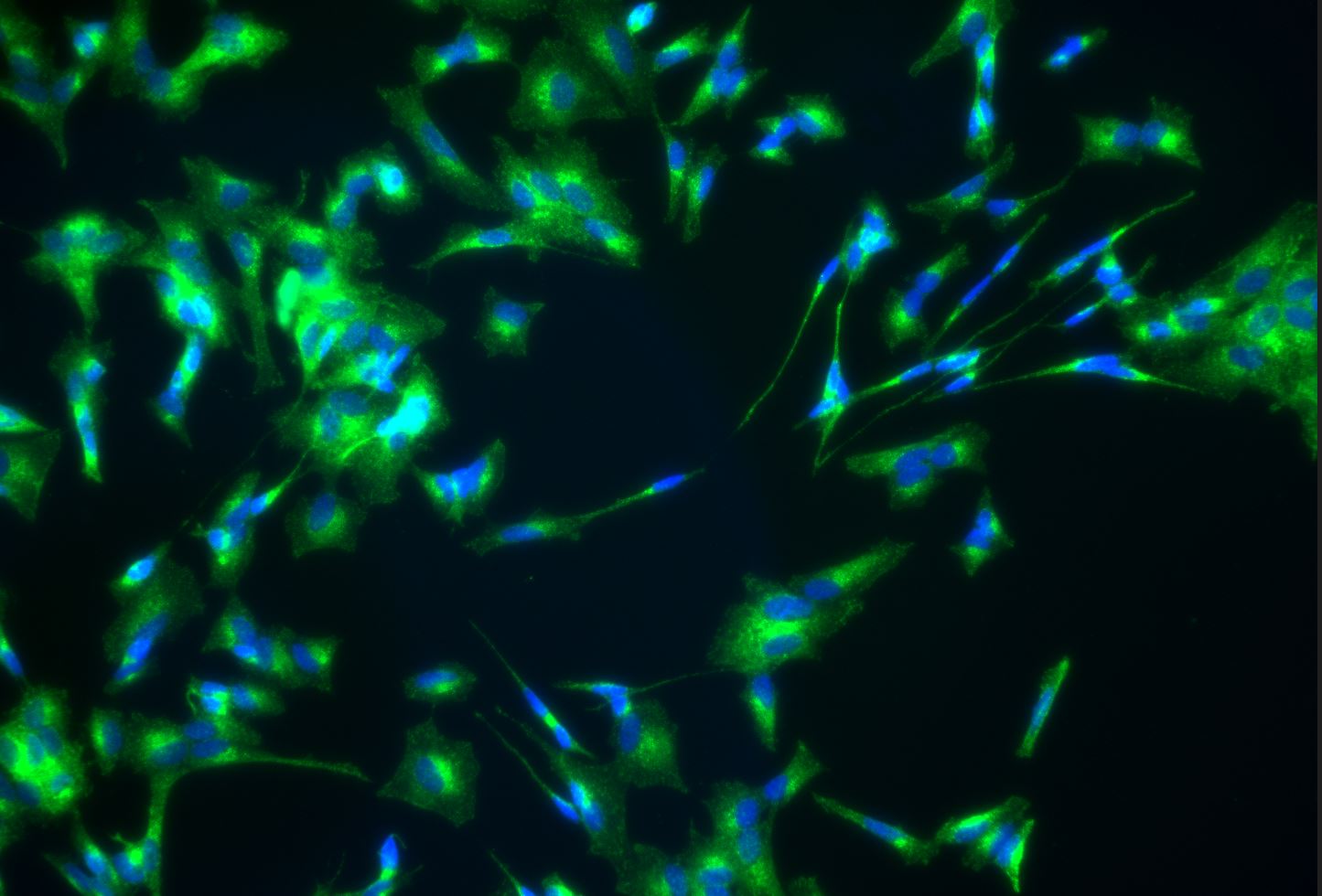 Clathrin Heavy Chain 1/CHC17 Antibody - BSA Free NBP2-49293