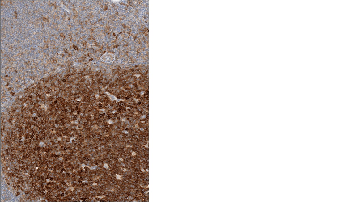 Semaphorin 4A Antibody - BSA Free NBP2-49588