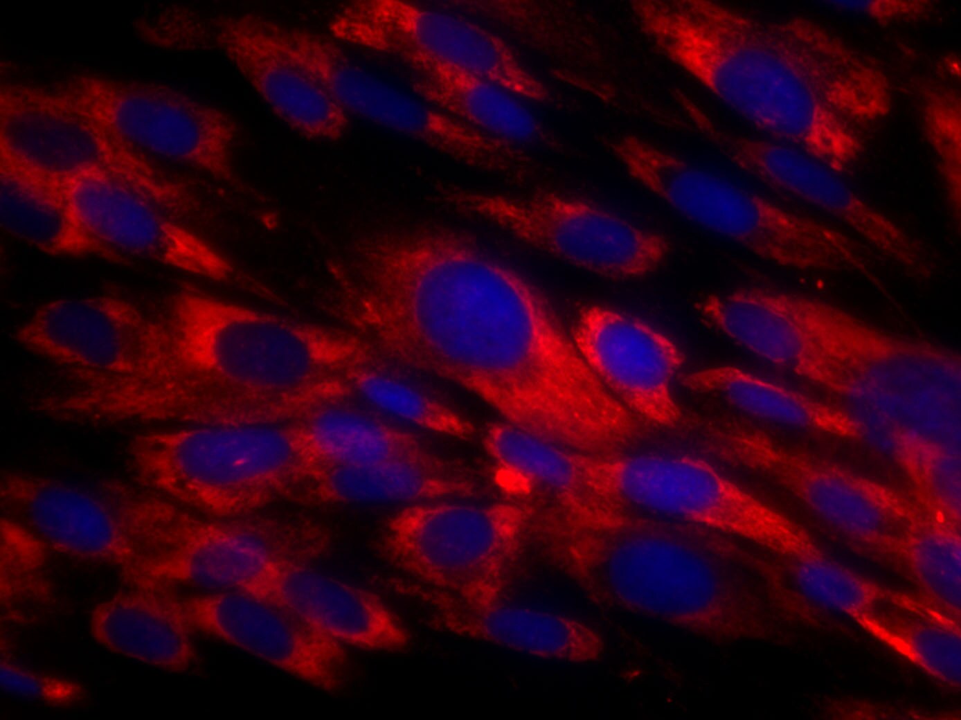 Fibroblasts Antibody (TE-7) NBP2-50082