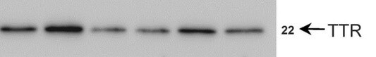 Transthyretin/Prealbumin Antibody (2E10C5) - BSA Free NBP2-52575