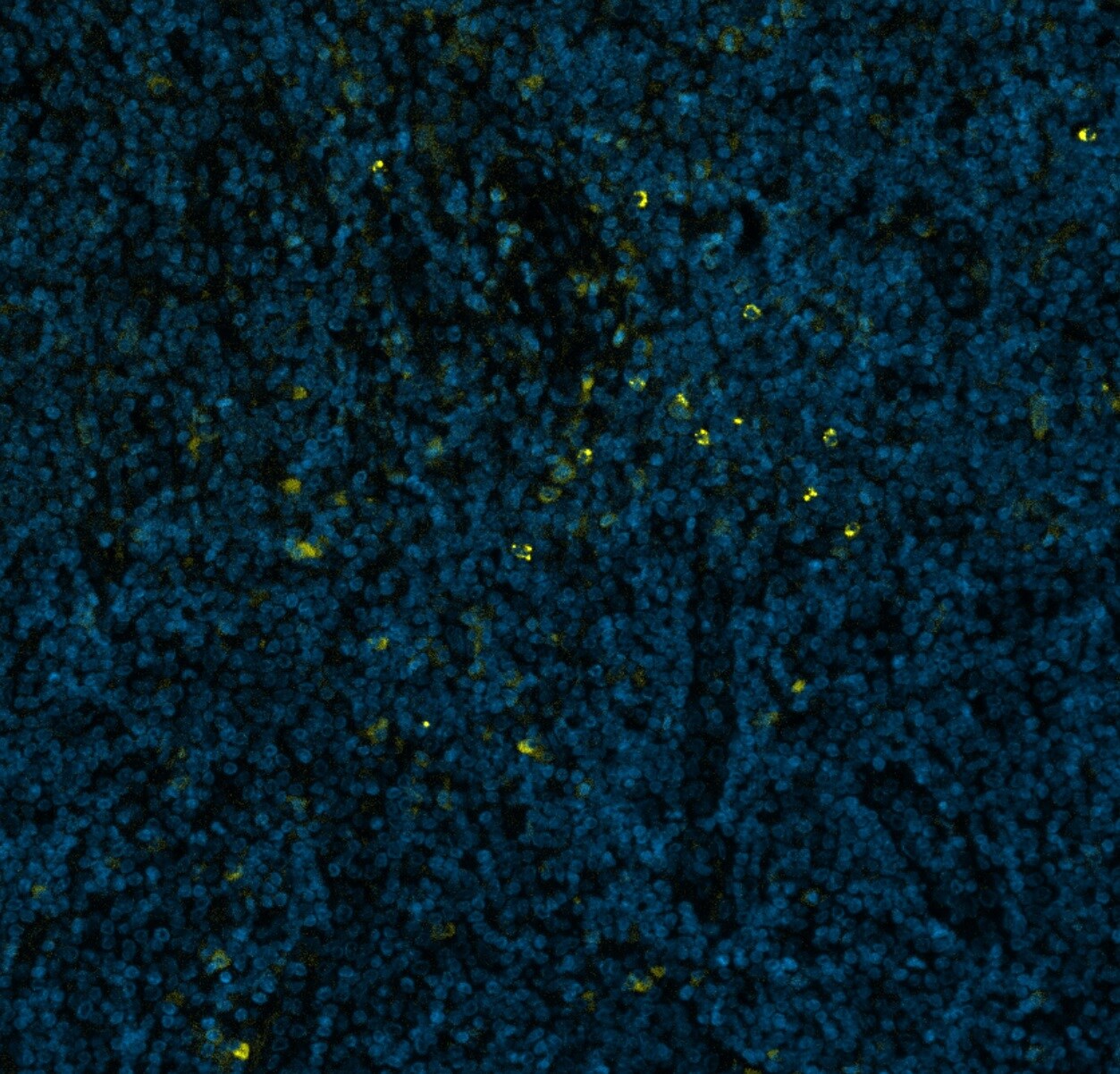 NCAM-1/CD56 Antibody (735) [Alexa Fluor® 647] NBP2-52710AF647
