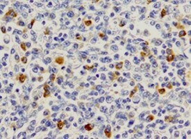 CD19 Antibody (FMC63) - Azide and BSA Free NBP2-52716
