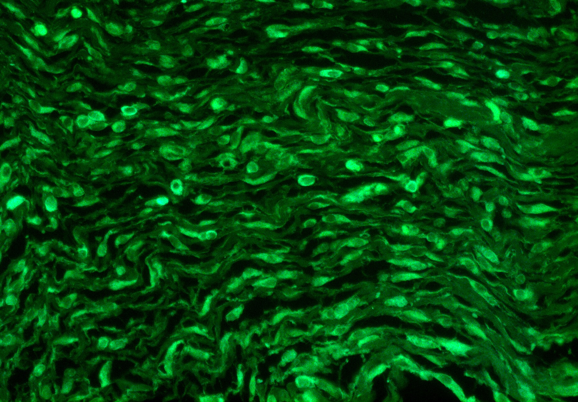 S100A4 Antibody (CL0237) - BSA Free NBP2-52890
