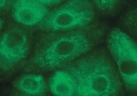 Transthyretin/Prealbumin Antibody (CL0290) - BSA Free NBP2-52905