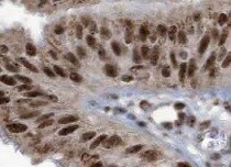 CTCF Antibody (CL0307) - BSA Free NBP2-52911