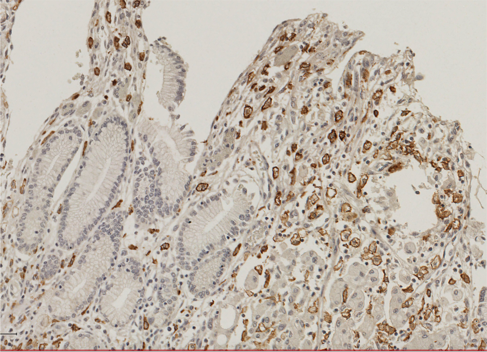 MMR/CD206/Mannose Receptor Antibody (CL0387) - BSA Free NBP2-52927